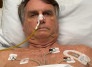 Bolsonaro teve alteração na pressão e continua sem movimentos intestinais efetivos - Reprodução/Redes sociais