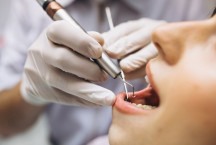 Cerca de 40 dentistas são demitidos em Teófilo Otoni; CRO-MG se pronuncia - DINO