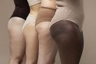 Lipedema vai além da estética e pode ter relação hormonal -  (crédito: DINO)