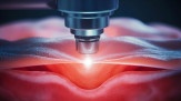 Laser traz mais precisão para cirurgias proctológicas -  (crédito: DINO)