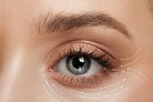  Close up. Beautiful female face, eye with lifting up arrows on background. Concept of bodycare, cosmetics, skincare, correction surgery, beauty and perfect skin. Flyer for your ad. Antiaging.
     -  (crédito: DINO)