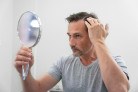 Tratamentos ampliam alternativas para calvície masculina -  (crédito: DINO)