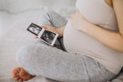 Ultrassom morfológico detalha formação fetal e prediz riscos - (crédito: DINO) Ultrassom morfológico detalha formação fetal e prediz riscos - (crédito: DINO)