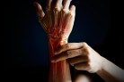 Acute pain in a woman wrist, colored in red on dark blue background. Health issues problems
- (crédito: DINO) Acute pain in a woman wrist, colored in red on dark blue background. Health issues problems
- (crédito: DINO)