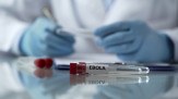  Worker of center for disease control describing effects of ebola virus mutation
       -  (crédito:  Getty Images)