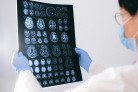 BrainAge: tecnologia indica a idade cerebral -  (crédito: DINO)