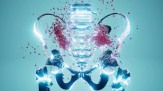 Cirurgia robótica amplia tratamento da endometriose - (crédito: DINO) Cirurgia robótica amplia tratamento da endometriose - (crédito: DINO)