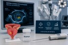 Diagnóstico preciso contribui para sucesso da robótica - (crédito: DINO) Diagnóstico preciso contribui para sucesso da robótica - (crédito: DINO)