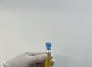 CFM regulamenta PRP em condições osteomusculares - (crédito: DINO) CFM regulamenta PRP em condições osteomusculares - (crédito: DINO)