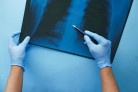 CONITEC abre consulta para Hipertensão Arterial Pulmonar - (crédito: DINO) CONITEC abre consulta para Hipertensão Arterial Pulmonar - (crédito: DINO)