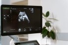 Vilo corial tem diagnóstico genético precoce - (crédito: DINO) Vilo corial tem diagnóstico genético precoce - (crédito: DINO)
