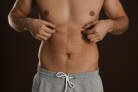 Definição em foco: a evolução da lipoaspiração masculina
- (crédito: Shutterstock) Definição em foco: a evolução da lipoaspiração masculina
- (crédito: Shutterstock)