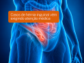 Casos de hérnia inguinal vêm exigindo atenção médica -  (crédito: DINO)